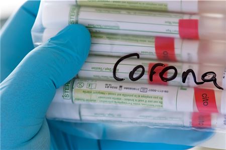 Proben für Corona-Tests werden für die weitere Untersuchung vorbereitet. 